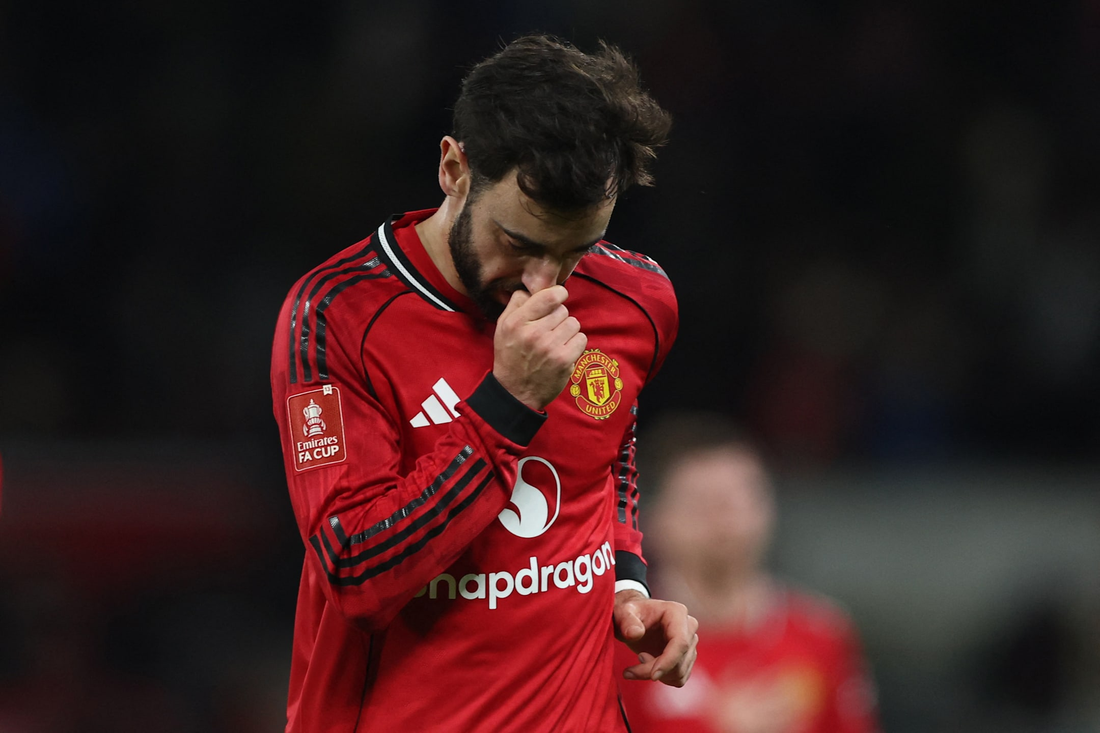 Manchester United ut av FA-cupen: –⁠ Et slag i trynet